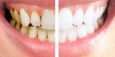 Alanyadental.net-Hizmetler02